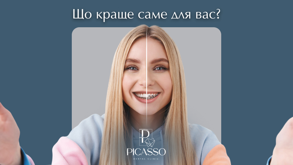 Що краще елайнери чи брекети?