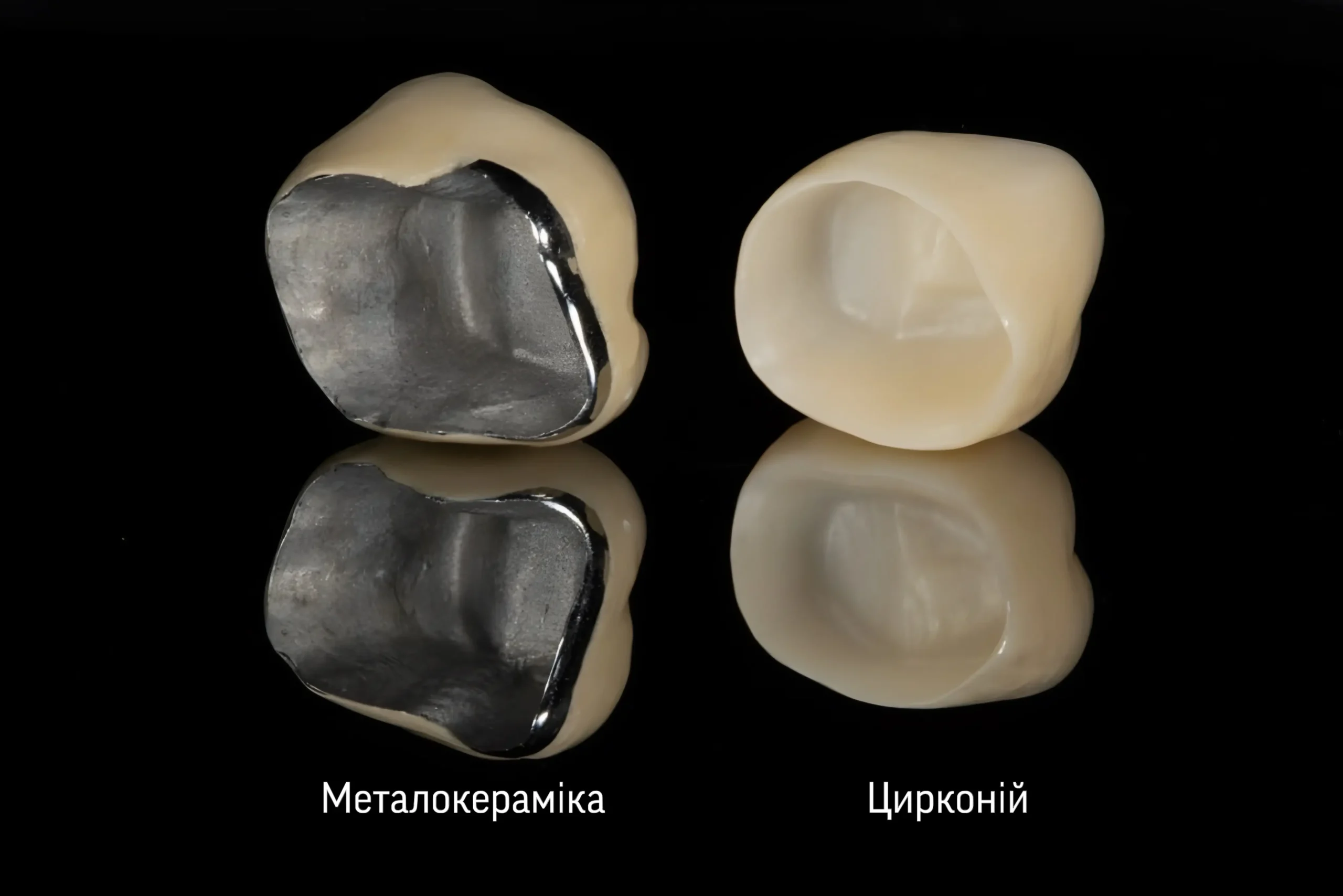 Металокерамічна коронка з металевою основою та цирконієва безметалева коронка — порівняння внутрішньої структури